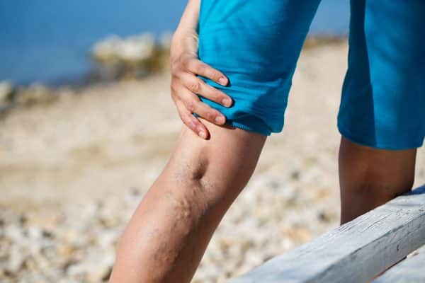 Are you looking for accurate information on varicose veins and vein treatments? In this article, a vein doctor near me in Newark provides valuable medical advice.