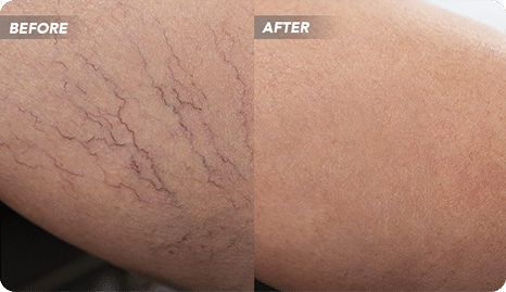VTCBefore-After-12_1