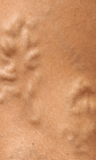 Mask-Group-45 What Doctor Treats Varicose Veins? And Other Important Vein FAQs