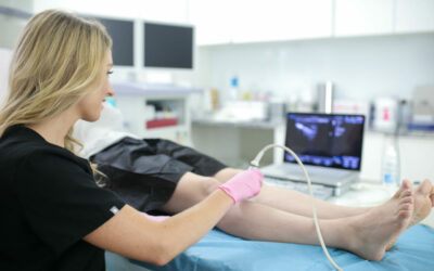 What Are The Best Treatments for Veins?