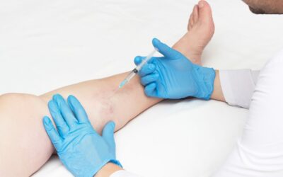 Comprehensive Guide to Varicose Veins Treatment Cost in New Jersey