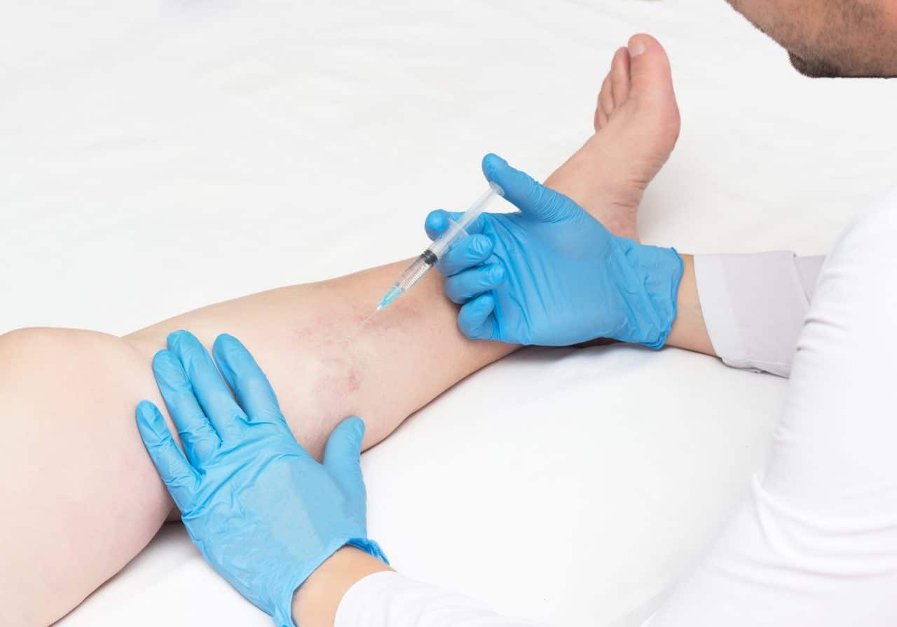 Looking for a “vein clinic near me”? Discover how New Jersey Vein Treatment's minimally invasive vein treatments can help with spider veins and varicose veins.