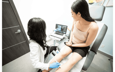 Non-Invasive Vein Treatments for All Ages: Compression Stockings, Lifestyle Changes, and More…