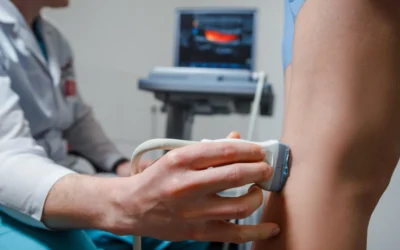 Clifton, NJ: Spider Vein Clinics and Other Top Choices Close to You